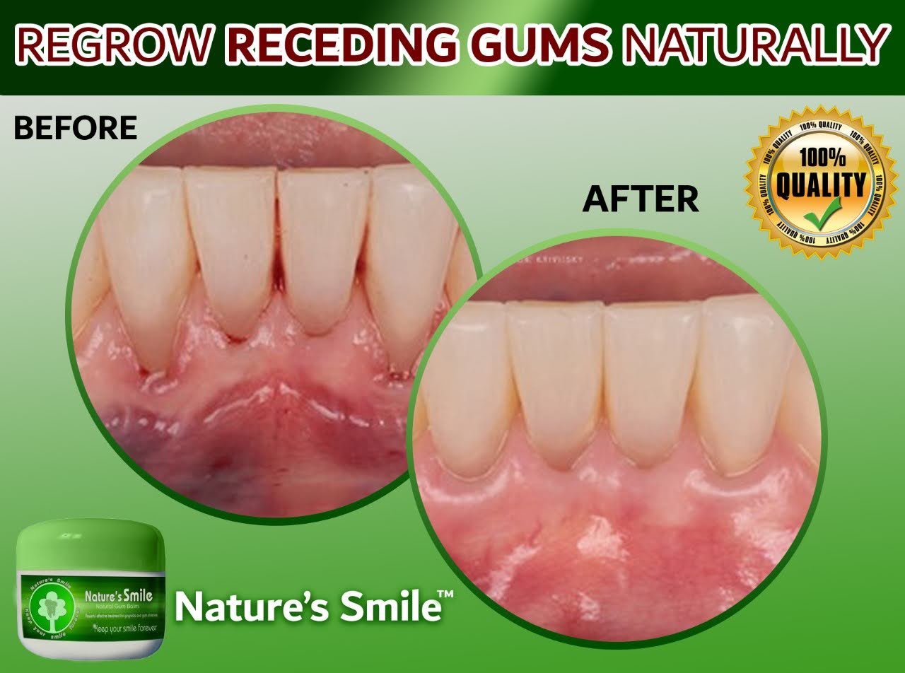 Order Natures Smile