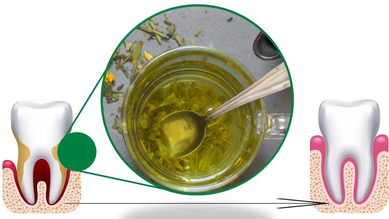 Green Tea Stop Gum Recession