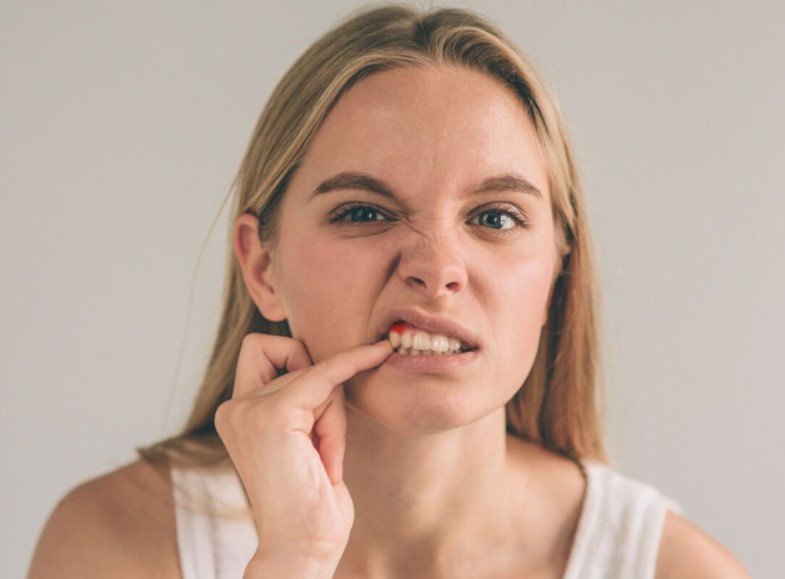 What Can Be Done for Receding Gums