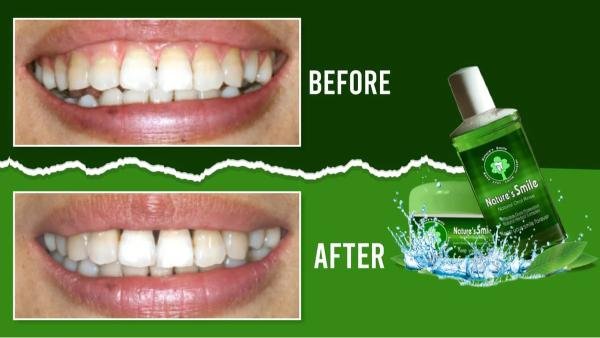 Natures Smile Reviews Before and After Results